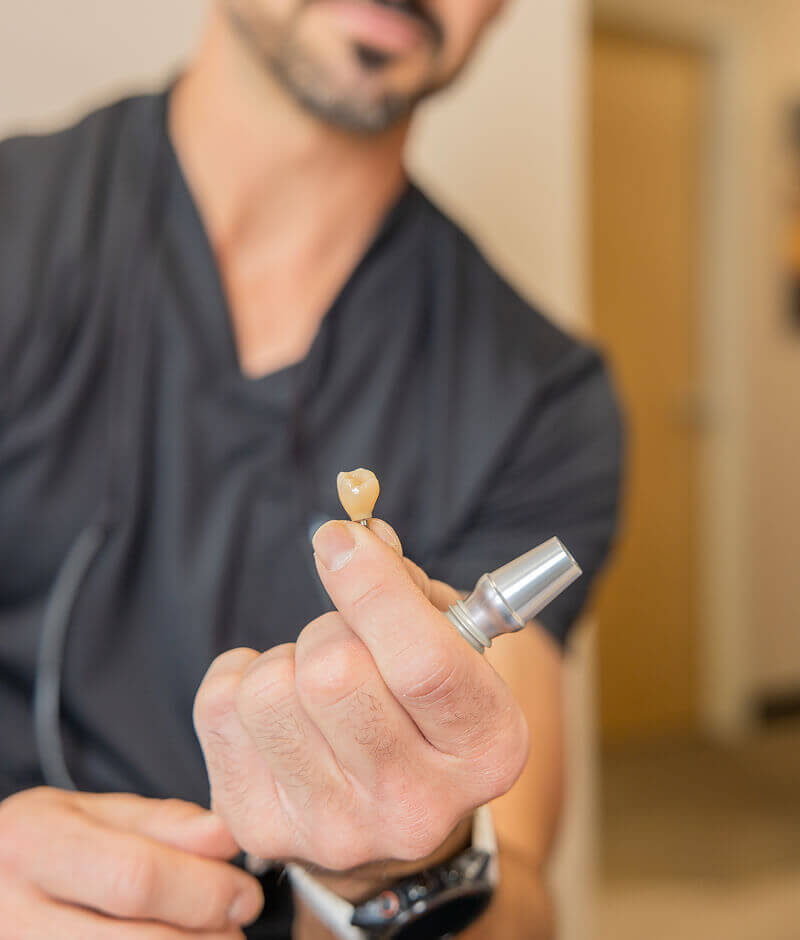 Dr Pocock holding a dental implant modal at Pocock Family Dental in Twin Falls ID.