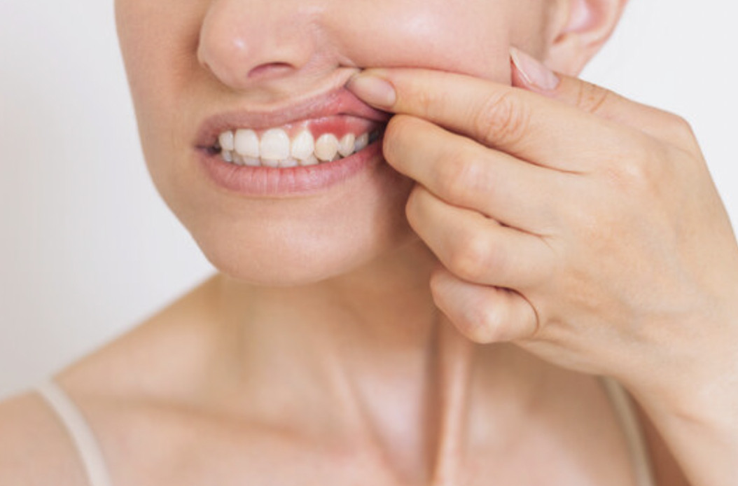 Featured image for “Early Signs of Gum Disease and How Preventive Dentistry in Twin Falls Protects Your Smile”